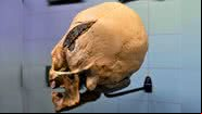 Crânio peruano foi doado para o Museu de Osteologia, nos Estados Unidos - Divulgação / Museu de Osteologia