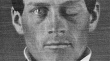 Retrato de Phineas Gage - Jack e Beverly Wilgus / Warren Anatomical Museum / Harvard Medical School / Wikimedia Commons